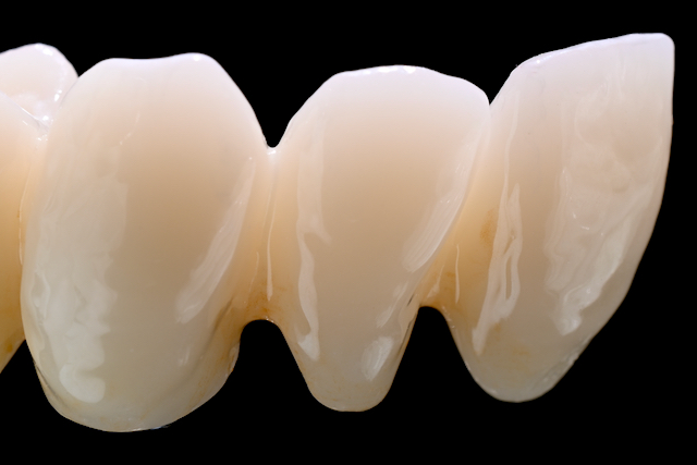 Multi Translucent PLUS Beispiel 3 Multi Translucent PLUS Beispiel 3