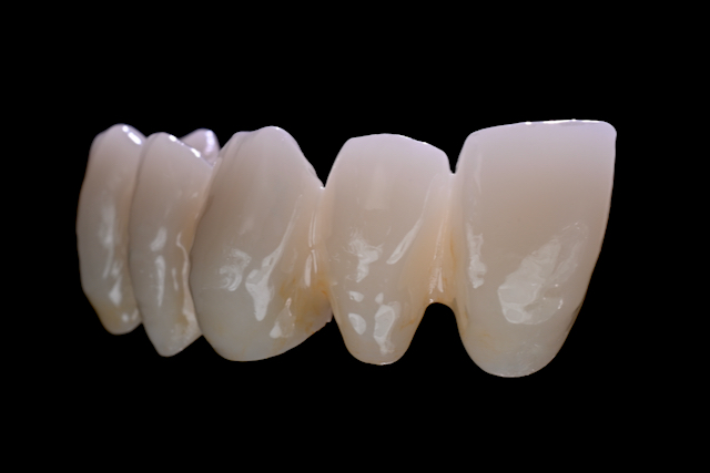 Multi Translucent PLUS Beispiel 1 Multi Translucent PLUS Beispiel 1